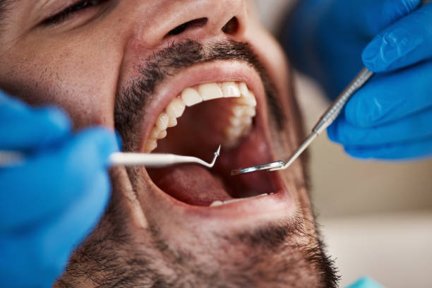 Best Tooth Infection Emergency Dentist  in Little Ferry, NJ
